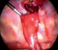 sop2.tif