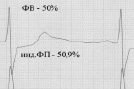 vor5b.tif