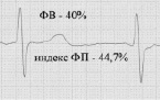 vor5c.tif