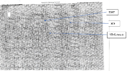 missing image file